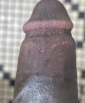 237